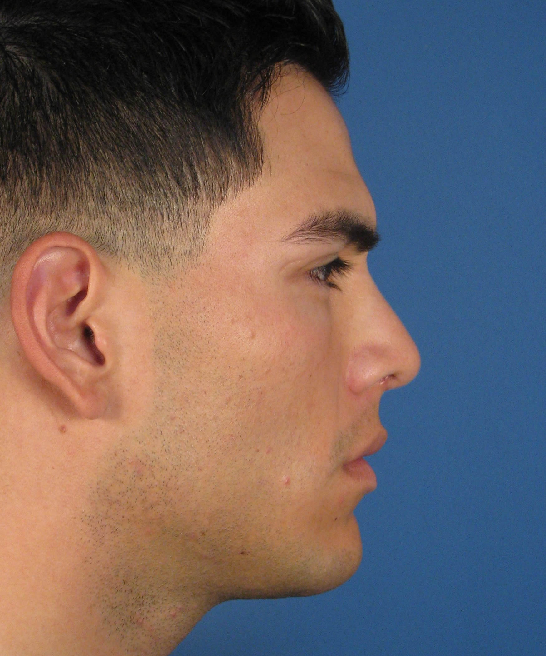 perfect male nose shape