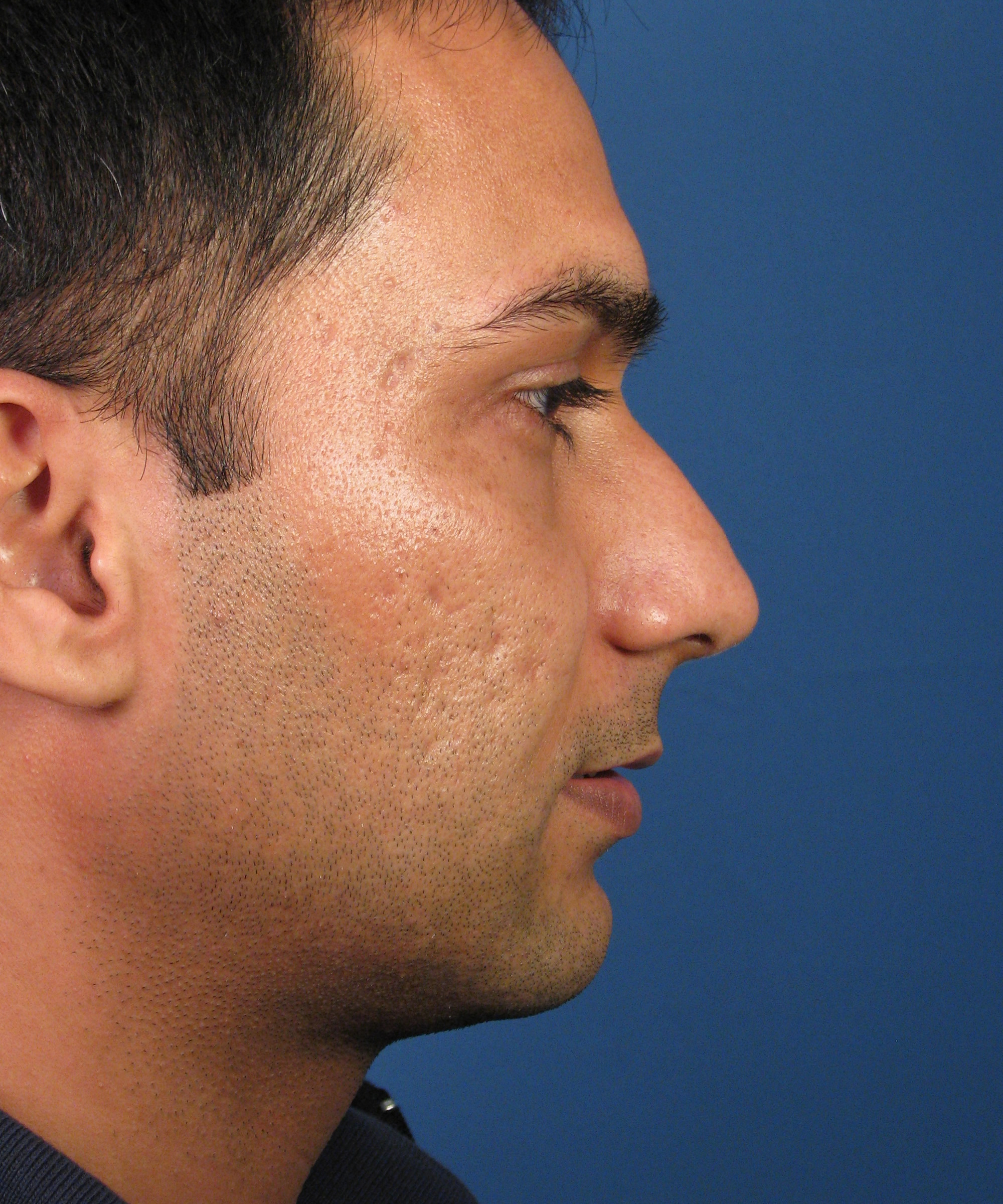 native american nose profile