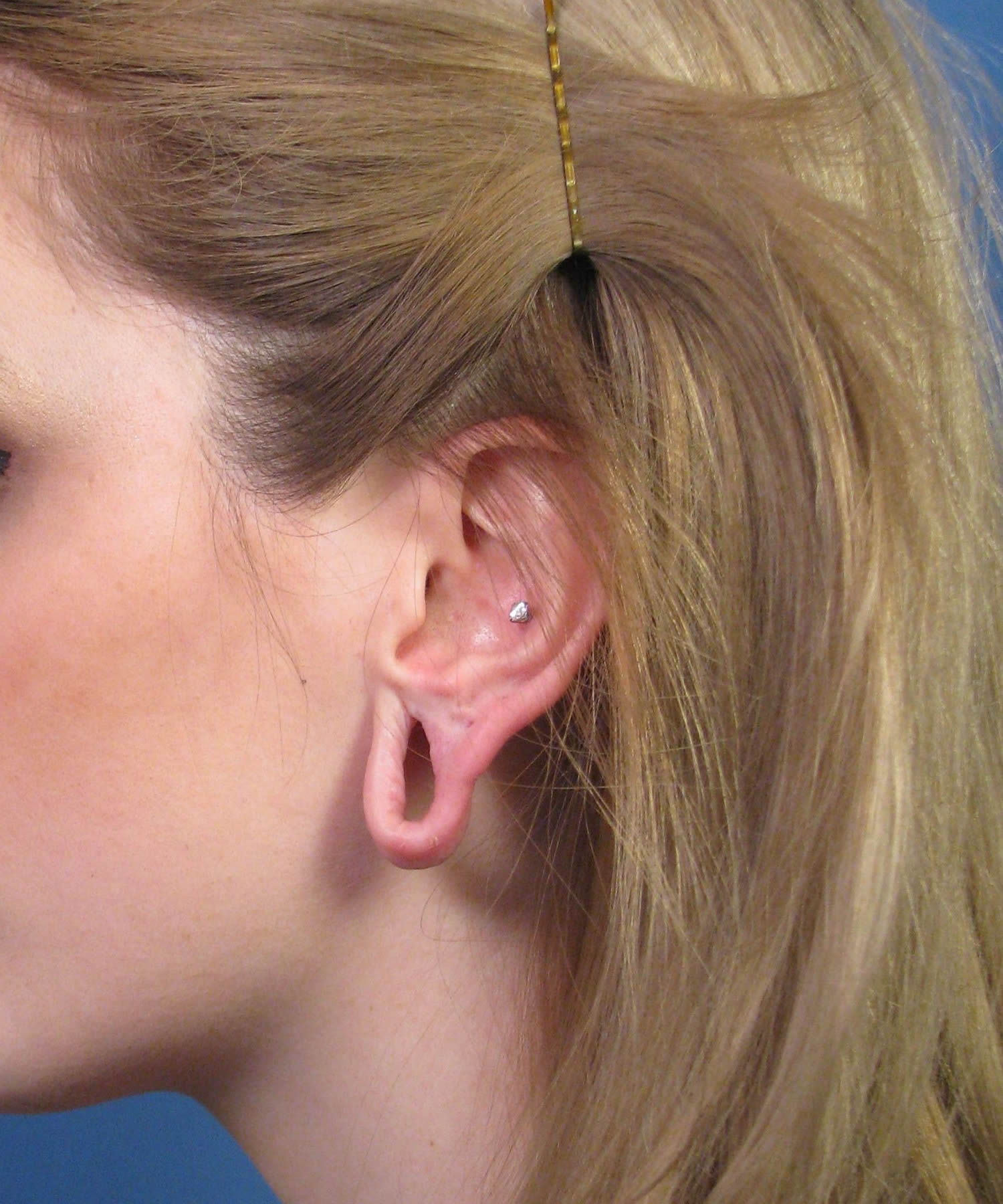 giant earlobes